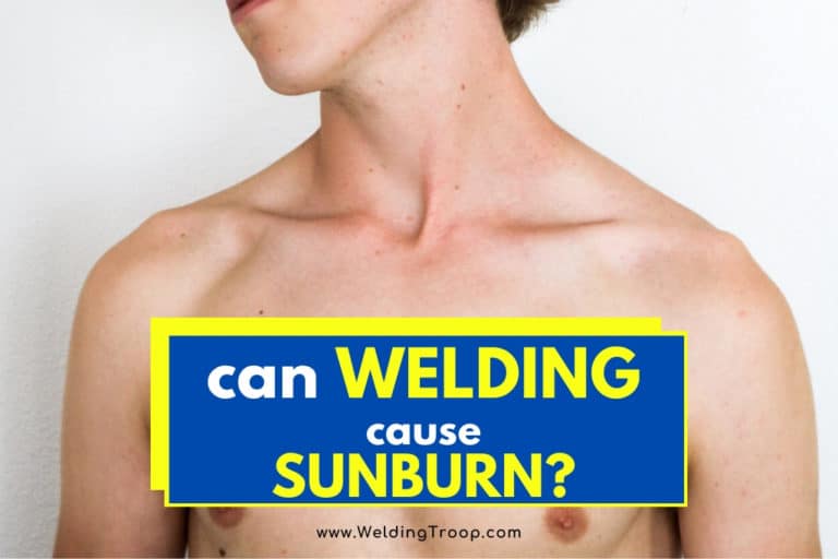 Can Welding Really Cause Sunburn? Effect On Skin and Eyes