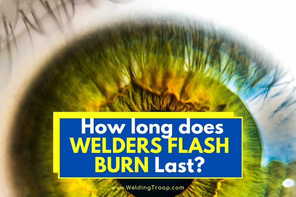 How Long Does Welders Flash burn Last