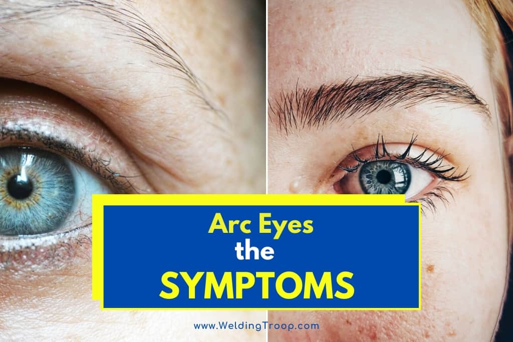 arc eye symptoms